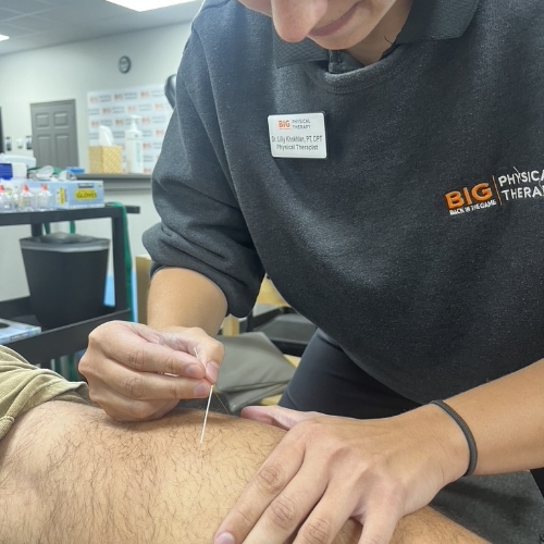 Dry-Needling-Back-In-The-Game-Physical-Therapy-Flowery-Branch-GA-Dacula-GA-Suwanee-GA-Gainesville-GA